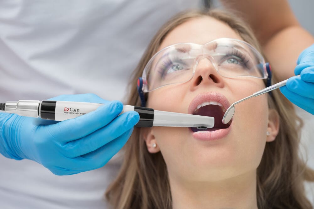 Telecamera Intraorale